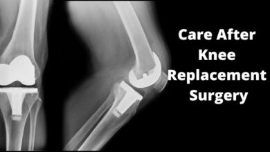 Care After Knee Replacement Surgery